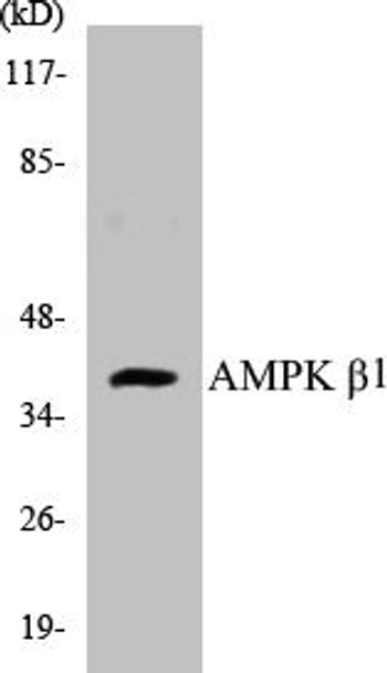 Metabolism AMPK beta1 Colorimetric Cell-Based ELISA Kit