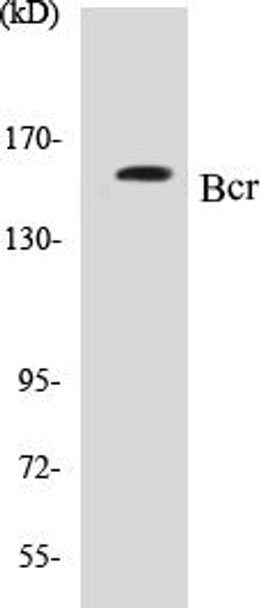 Bcr Colorimetric Cell-Based ELISA Kit