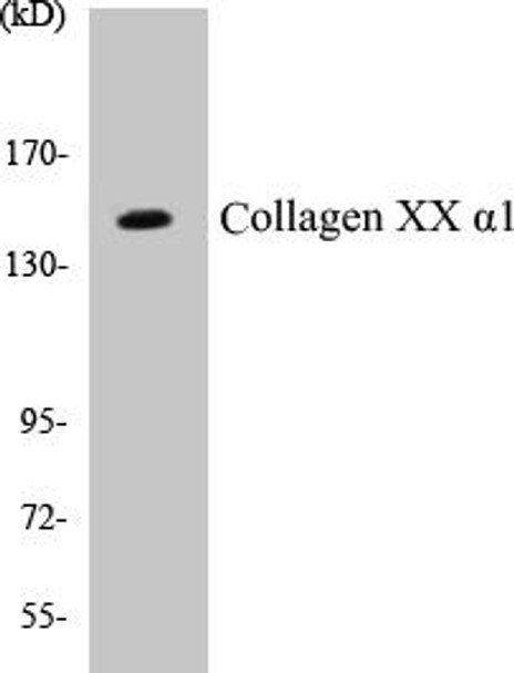 Collagen XX alpha1 Colorimetric Cell-Based ELISA Kit