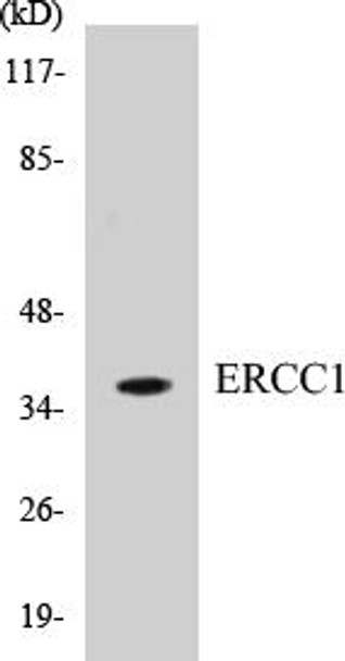 Epigenetics and Nuclear Signaling ERCC1 Colorimetric Cell-Based ELISA Kit