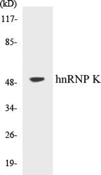 Immunology hnRNP K Colorimetric Cell-Based ELISA Kit