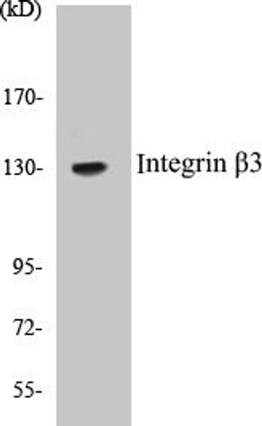 Cell Biology Integrin beta3 Colorimetric Cell-Based ELISA Kit