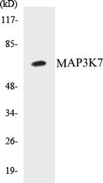 Cell Death MAP3K7 Colorimetric Cell-Based ELISA Kit