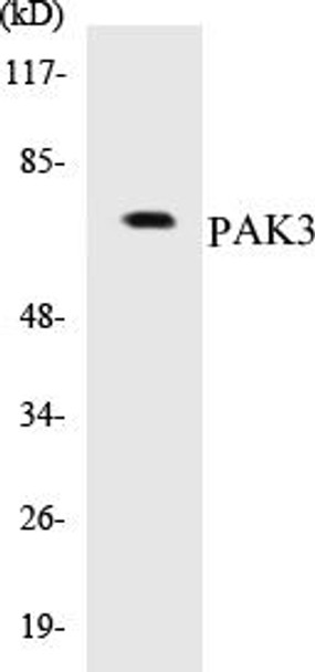 PAK3 Colorimetric Cell-Based ELISA Kit