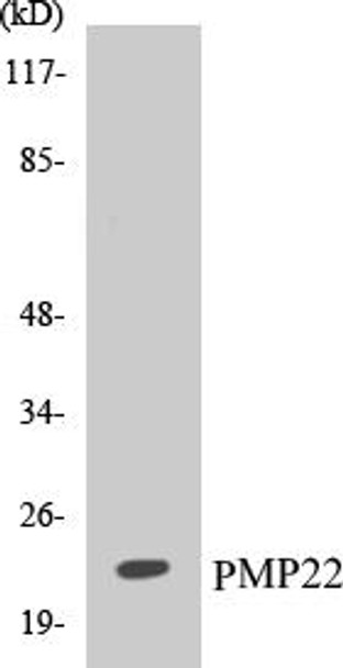 PMP22 Colorimetric Cell-Based ELISA Kit