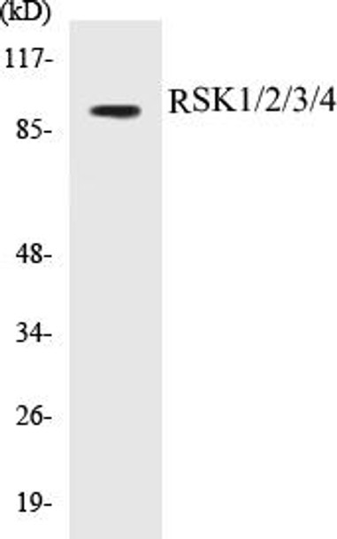 Cell Cycle ELISA Kits RSK1/2/3/4 Colorimetric Cell-Based ELISA Kit