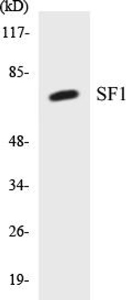 Epigenetics and Nuclear Signaling SF1 Colorimetric Cell-Based ELISA Kit