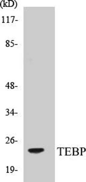 Metabolism TEBP Colorimetric Cell-Based ELISA Kit