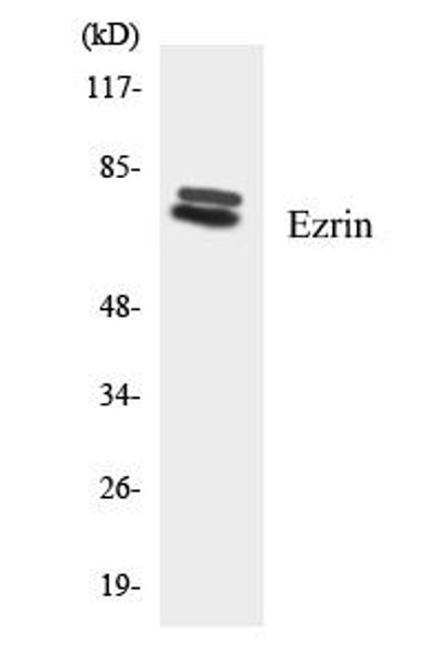 Cell Biology Ezrin Colorimetric Cell-Based ELISA