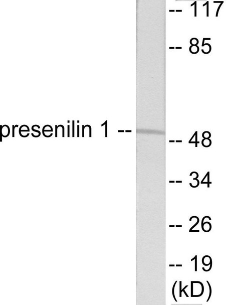 Cell Death Presenilin 1 Colorimetric Cell-Based ELISA