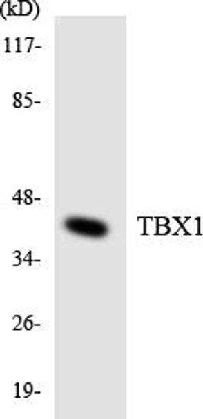 Epigenetics and Nuclear Signaling TBX1 Colorimetric Cell-Based ELISA