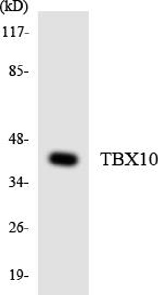 Epigenetics and Nuclear Signaling TBX10 Colorimetric Cell-Based ELISA