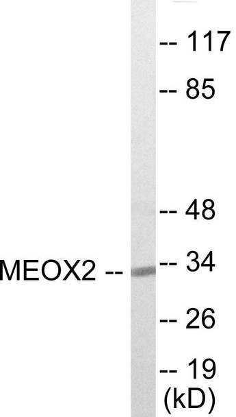 Epigenetics and Nuclear Signaling MEOX2 Colorimetric Cell-Based ELISA