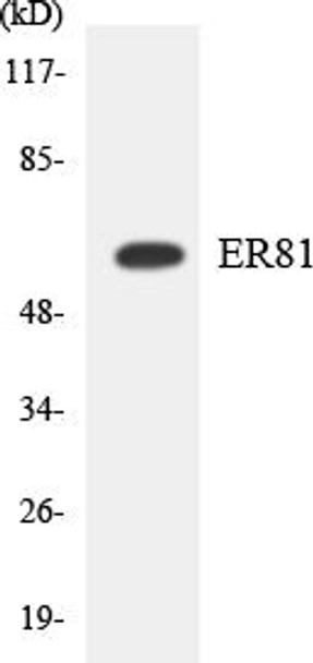 Epigenetics and Nuclear Signaling ER81 Colorimetric Cell-Based ELISA