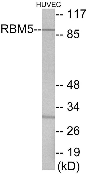 Cell Death RBM5 Colorimetric Cell-Based ELISA