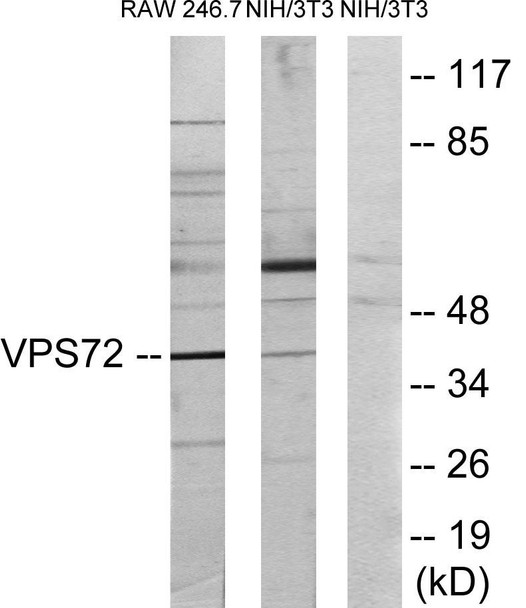 Epigenetics and Nuclear Signaling VPS72 Colorimetric Cell-Based ELISA