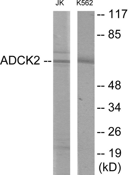 ADCK2 Colorimetric Cell-Based ELISA