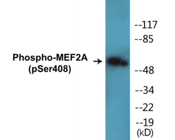 MEF2A Phospho-Ser408 Colorimetric Cell-Based ELISA Kit