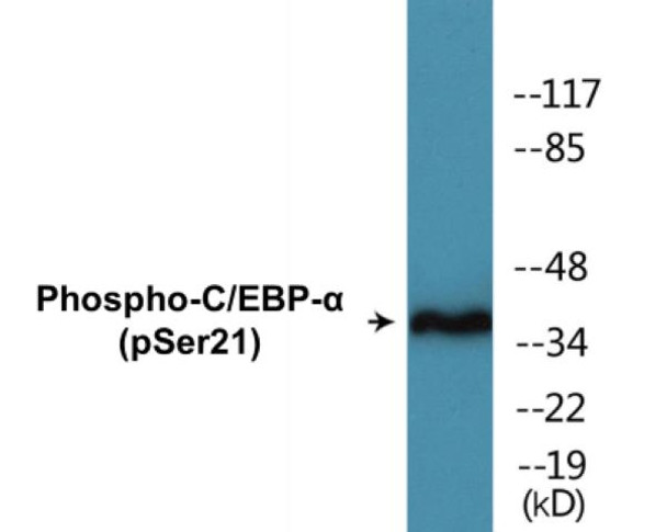 C/EBP-alpha Phospho-Ser21 Colorimetric Cell-Based ELISA Kit