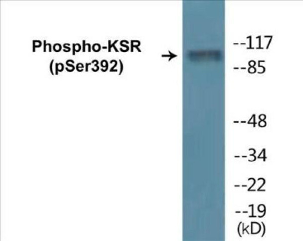KSR Phospho-Ser392 Colorimetric Cell-Based ELISA Kit
