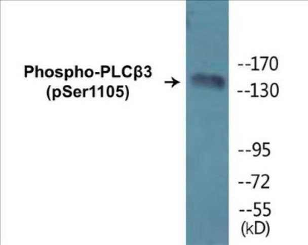 PLCbeta3 Phospho-Ser1105 Colorimetric Cell-Based ELISA Kit