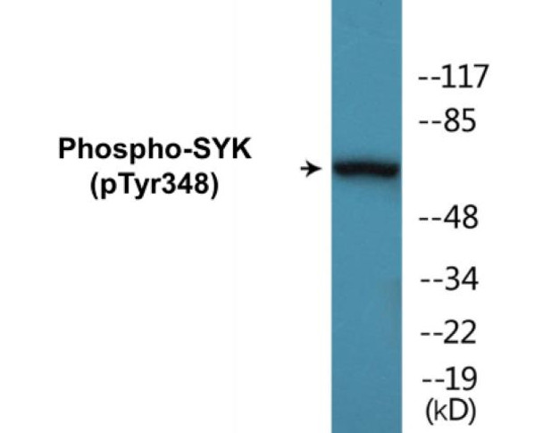 SYK Phospho-Tyr348 Colorimetric Cell-Based ELISA Kit
