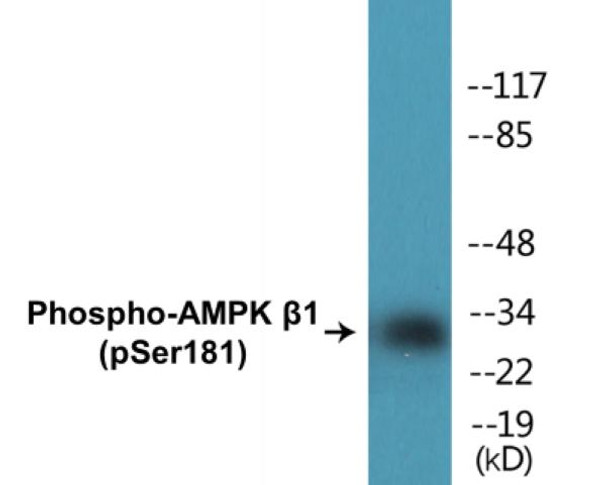 AMPK beta1 Phospho-Ser181 Colorimetric Cell-Based ELISA Kit