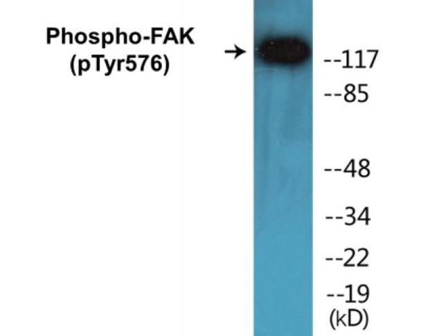 FAK Phospho-Tyr576 Colorimetric Cell-Based ELISA Kit