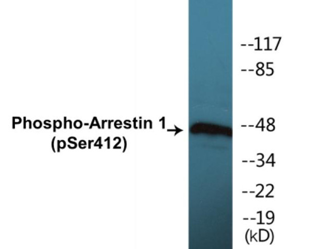 Arrestin 1 Phospho-Ser412 Colorimetric Cell-Based ELISA Kit