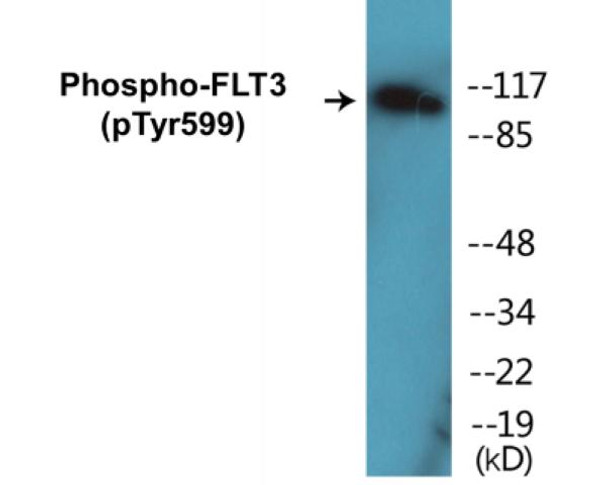 FLT3 Phospho-Tyr599 Colorimetric Cell-Based ELISA Kit