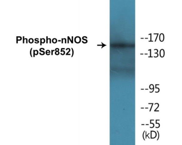 nNOS Phospho-Ser852 Colorimetric Cell-Based ELISA Kit