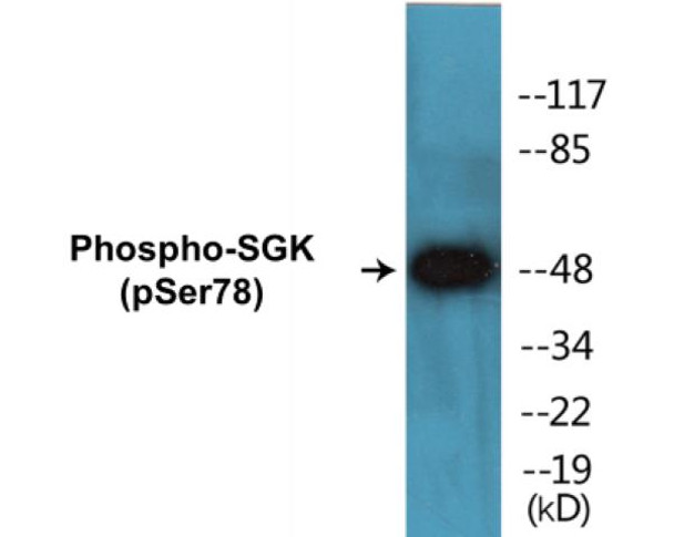SGK Phospho-Ser78 Colorimetric Cell-Based ELISA Kit