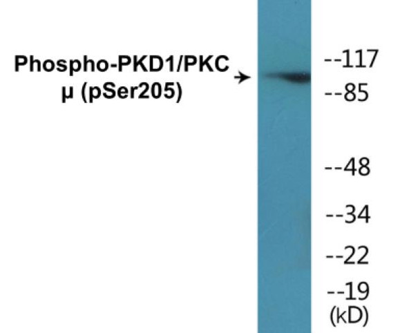 PKD1/PKC mu Phospho-Ser205 Colorimetric Cell-Based ELISA Kit