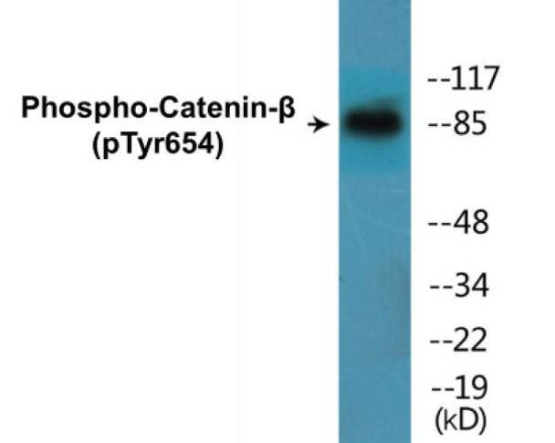Catenin-beta Phospho-Tyr654 Colorimetric Cell-Based ELISA Kit
