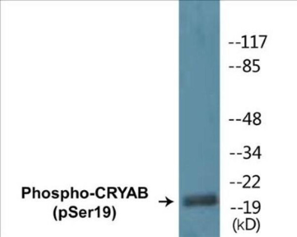 CRYAB Phospho-Ser19 Colorimetric Cell-Based ELISA Kit