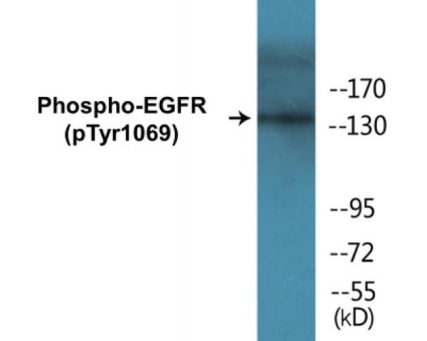 EGFR Phospho-Tyr1069 Colorimetric Cell-Based ELISA Kit