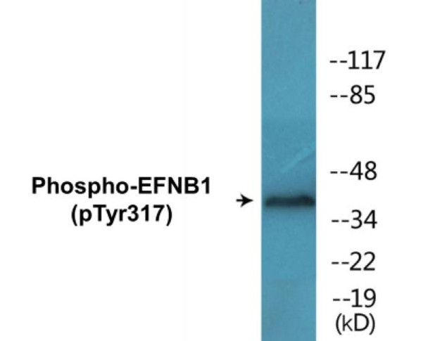 EFNB1 Phospho-Tyr317 Colorimetric Cell-Based ELISA Kit