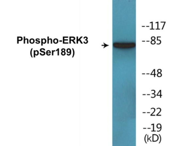 ERK3 Phospho-Ser189 Colorimetric Cell-Based ELISA Kit