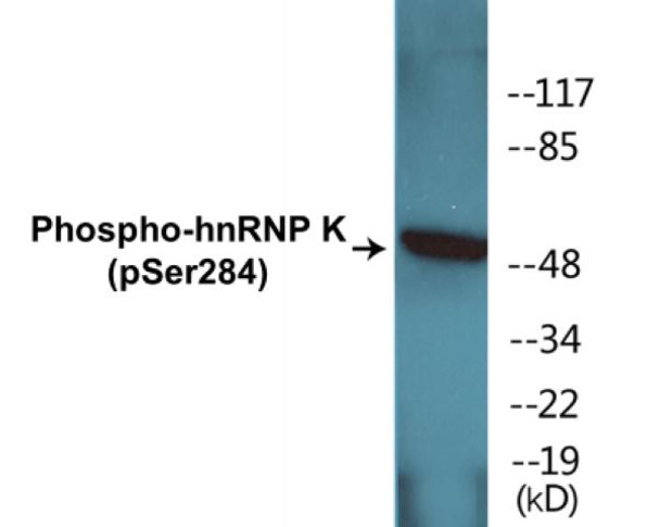 hnRNP K Phospho-Ser284 Colorimetric Cell-Based ELISA Kit
