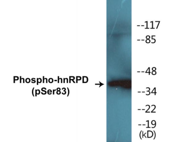 hnRPD Phospho-Ser83 Colorimetric Cell-Based ELISA Kit