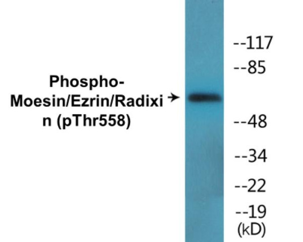 Moesin/Ezrin/Radixin Phospho-Thr558 Colorimetric Cell-Based ELISA Kit