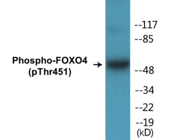 FOXO4 Phospho-Thr451 Colorimetric Cell-Based ELISA Kit