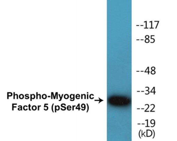 Myogenic Factor 5 Phospho-Ser49 Colorimetric Cell-Based ELISA Kit