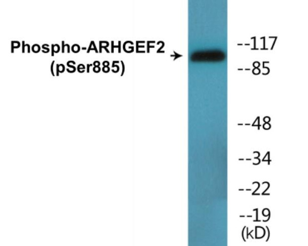 ARHGEF2 Phospho-Ser885 Colorimetric Cell-Based ELISA Kit