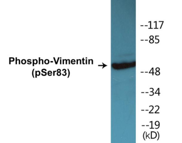 Vimentin Phospho-Ser83 Colorimetric Cell-Based ELISA Kit