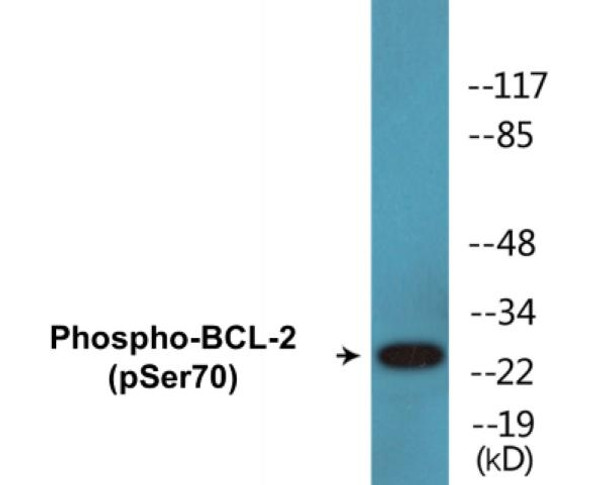 BCL-2 Phospho-Ser70 Colorimetric Cell-Based ELISA Kit