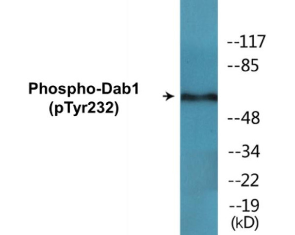 Dab1 Phospho-Tyr232 Colorimetric Cell-Based ELISA Kit