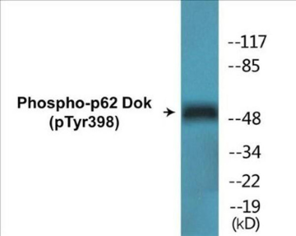 p62 Dok Phospho-Tyr398 Colorimetric Cell-Based ELISA Kit