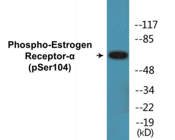 Estrogen Receptor-alpha Phospho-Ser104 Colorimetric Cell-Based ELISA Kit
