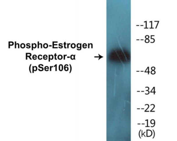 Estrogen Receptor-alpha Phospho-Ser106 Colorimetric Cell-Based ELISA Kit